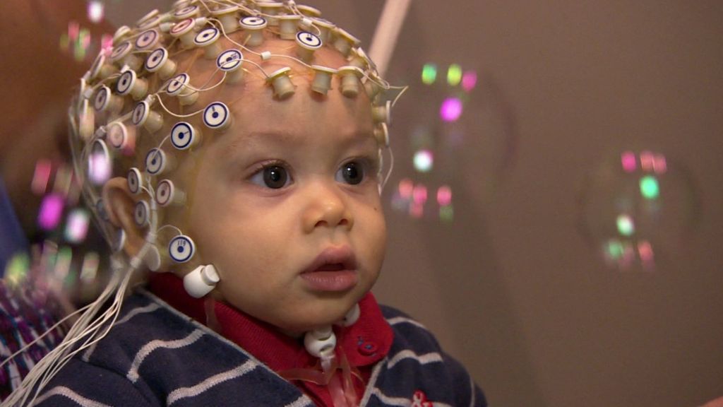 Ээг головы ребенку. ЭЭГ. Электроэнцефалография у детей. Энцефалограмма детям. ЭЭГ головного мозга ребенку.